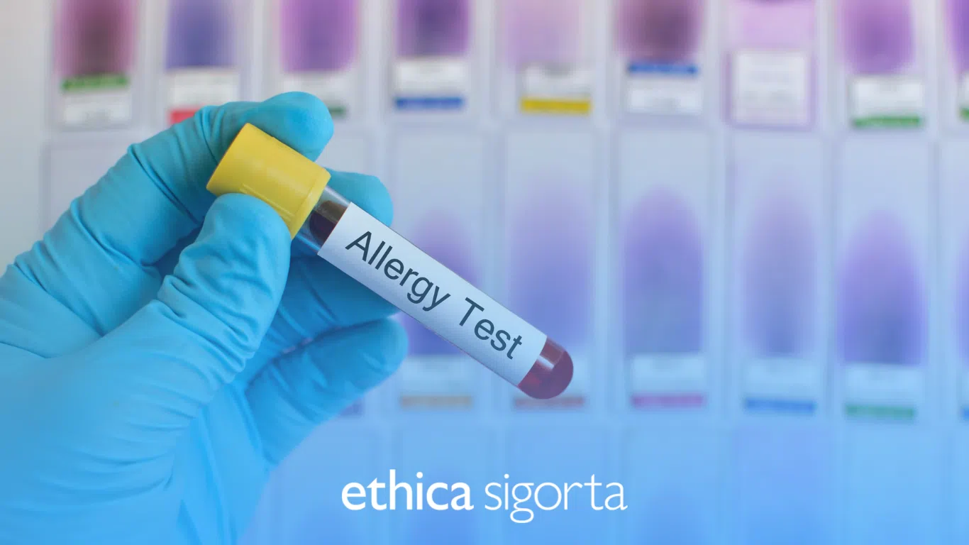 Alerji Testi Nedir? Özel ve Tamamlayıcı Sağlık Sigortası Alerji Testini Karşılar Mı?