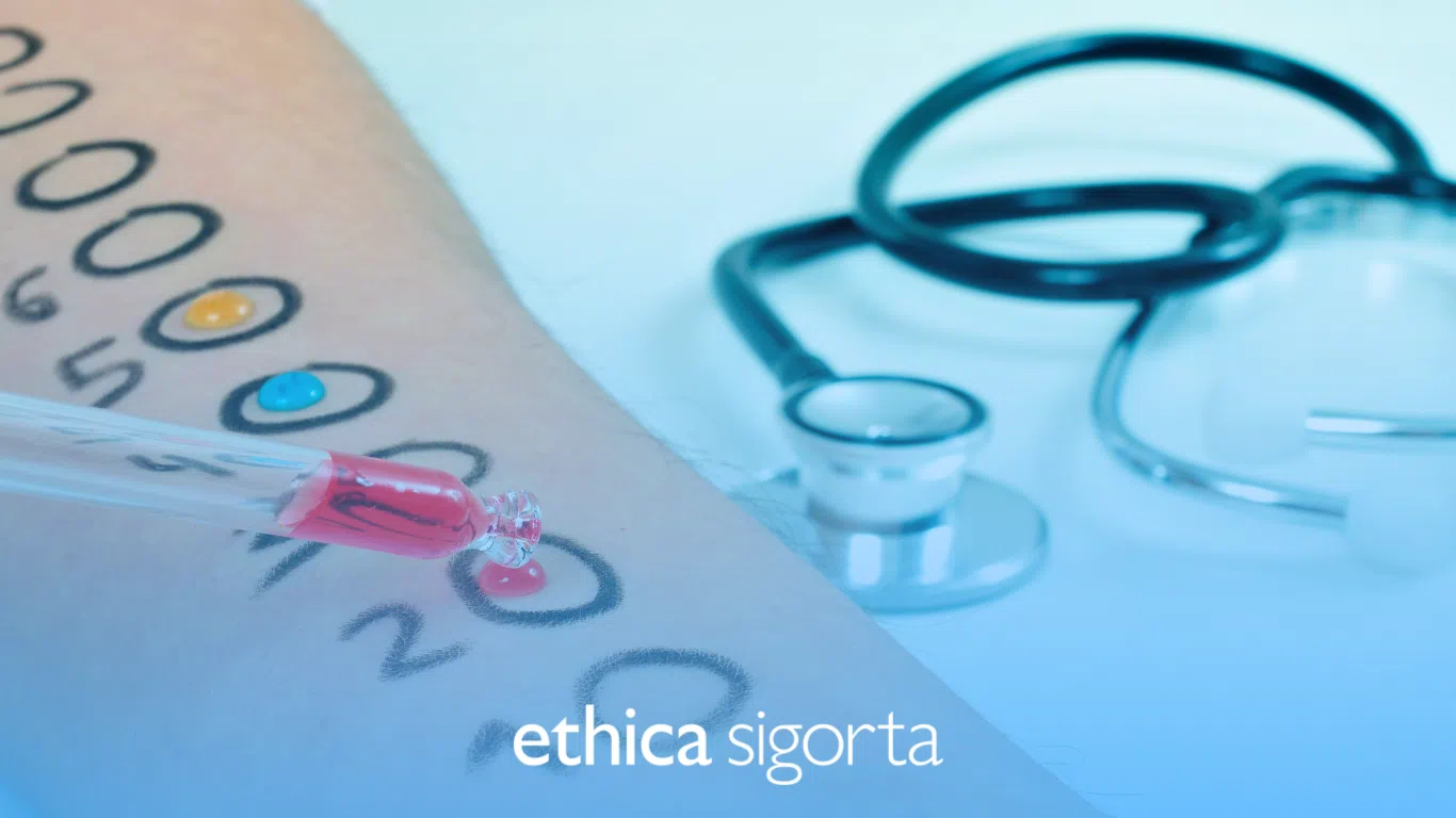 Alerji Testi Nedir? Özel ve Tamamlayıcı Sağlık Sigortası Alerji Testini Karşılar Mı?